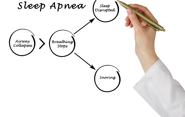 can you have sleep apnew without snoring